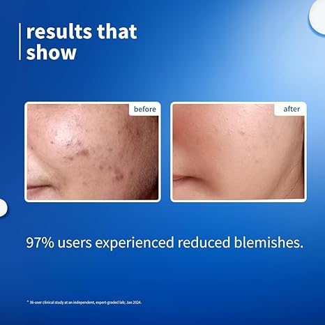 Plum Rice Water & Niacinamide 10% Serum 30 Ml