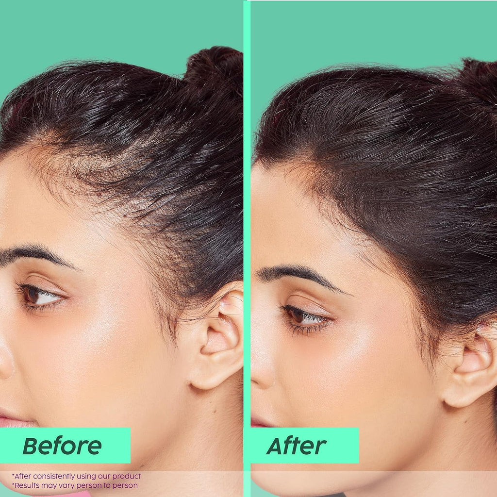 PLIX ROSEMARY ANTI HAIRFALL SHAMPOO