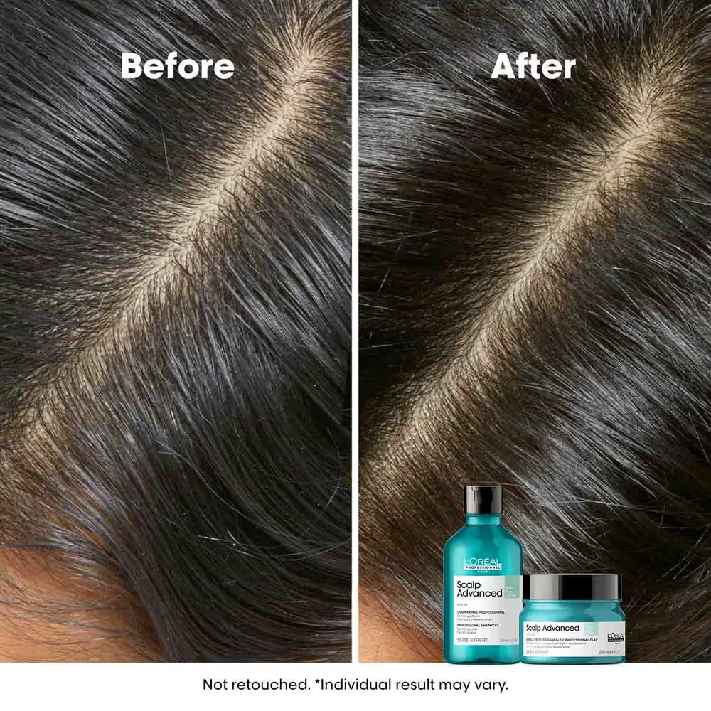 LOREAL SCALP ADVANCE Anti-Oiliness SHAMPOO (300 ml)