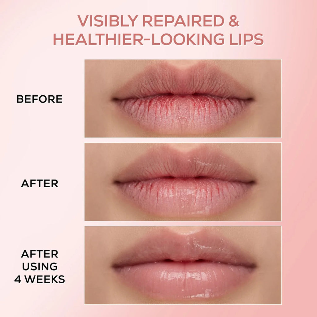 RENEE PINK THERAPY LIP BALM
