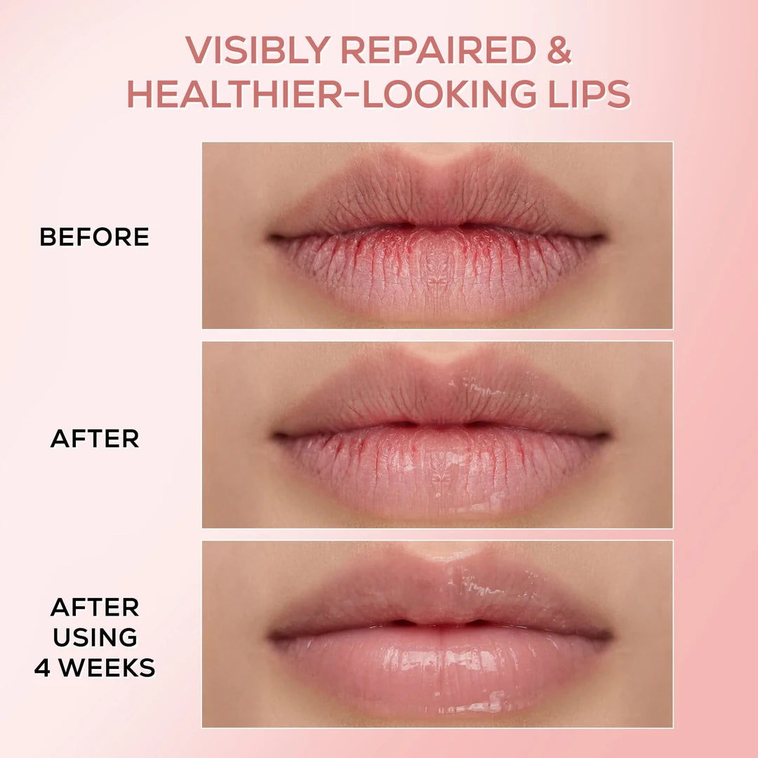 RENEE PINK THERAPY LIP BALM