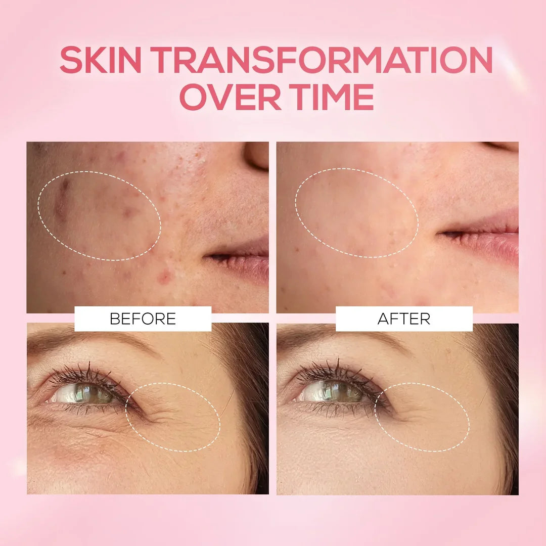 RENEE PINK THERAPY COLLAGEN SERUM