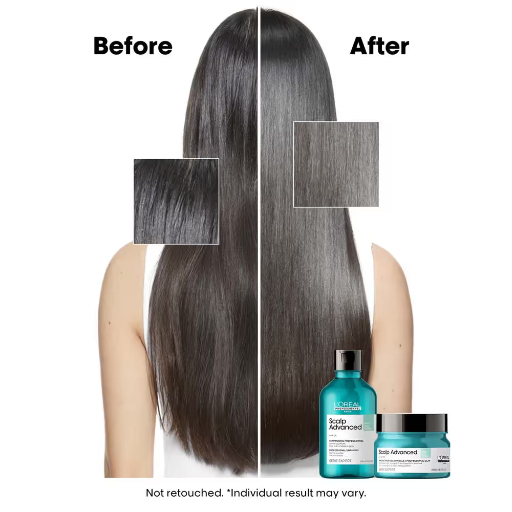 LOREAL SCALP ADVANCE Anti-Oiliness SHAMPOO (300 ml)